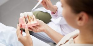 Explaining Tooth Implantation