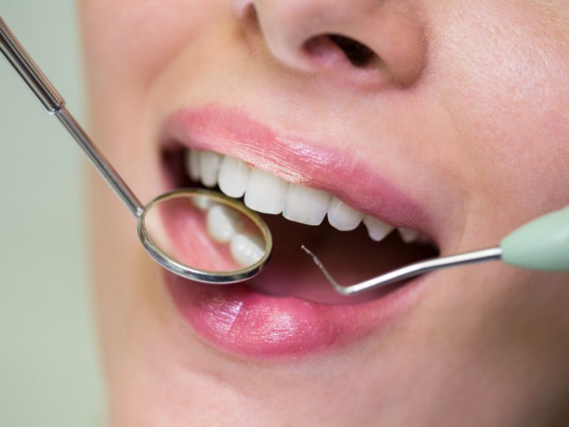 Gece Açık Diş Kliniği Ne Zaman Tercih Edilir?