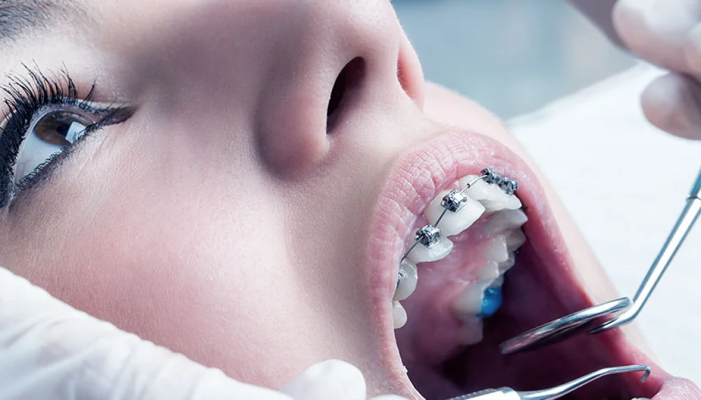 Nöbetçi Diş Kliniği Hangi Hizmetleri Sunar?
