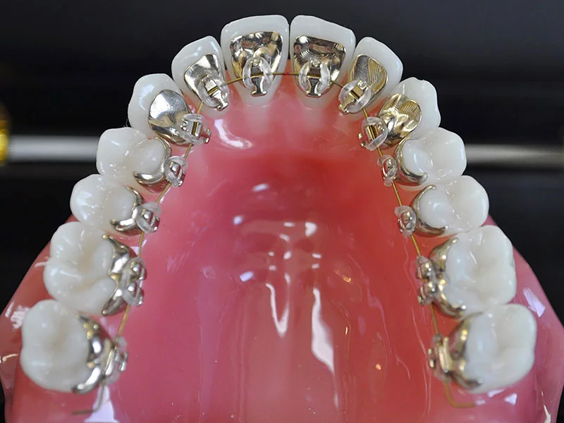Ankara Ortodontist